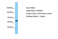 SORBS2 Antibody, Novus Biologicals 100 &mu;L; Unconjugated:Antikörper